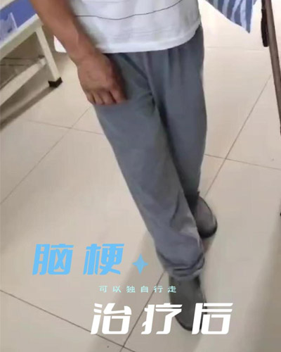 康复案例：沂南地区-李先生