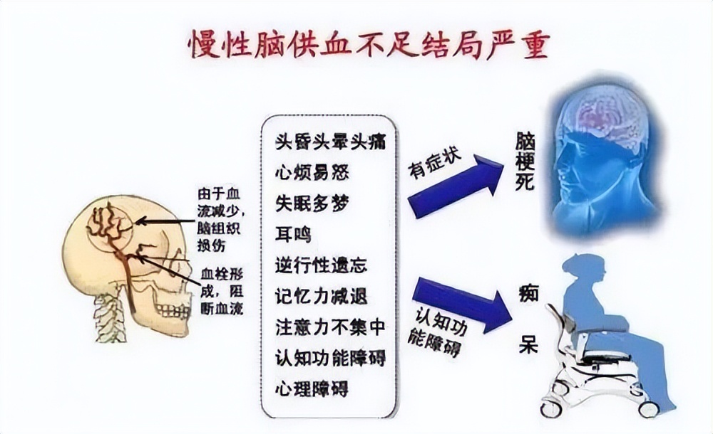 脑供血不足的预防建议